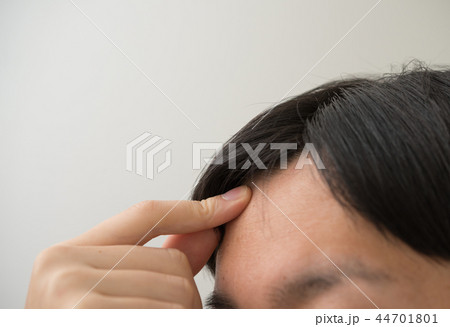 おでこ［ネガティブ利用可能］ 44701801