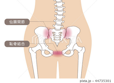 骨盤の緩み 腰部 肌色 44735301
