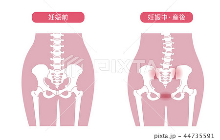 骨盤の緩み 腰部比較 44735591