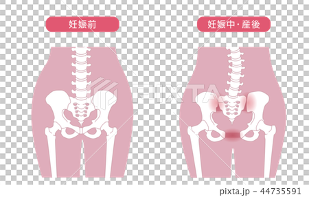 骨盤の緩み 腰部比較 44735591