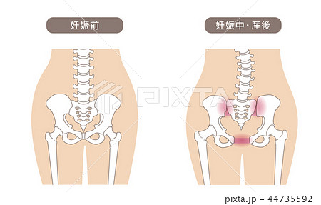 骨盤の緩み 腰部比較 44735592