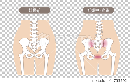 骨盤の緩み 腰部比較 44735592