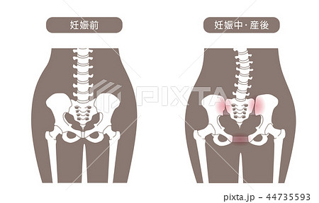 骨盤の緩み 腰部比較 44735593