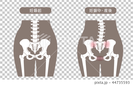 骨盤の緩み 腰部比較 44735593
