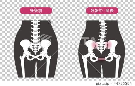 骨盤の緩み 腰部比較 骨盤の緩み 腰部比較 44735594