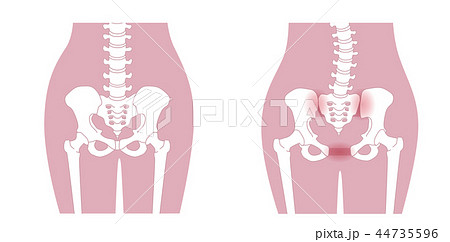 骨盤の緩み 腰部比較 44735596