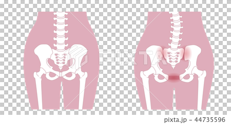 骨盤の緩み 腰部比較 44735596