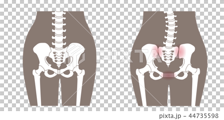 骨盆鬆動 骨盆鬆動 44735598
