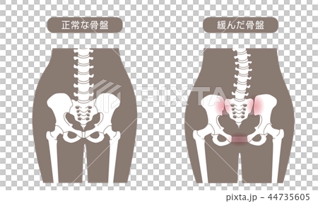 骨盤の緩み 腰部比較 44735605