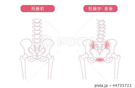 骨盤の緩み 腰部比較 44735721
