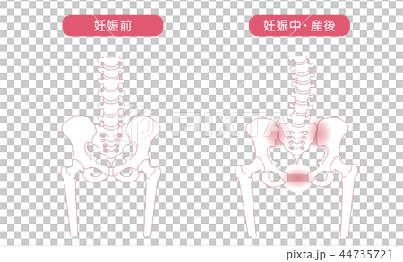 骨盤の緩み 腰部比較 44735721