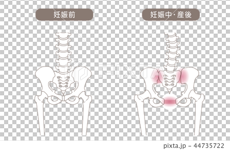 骨盤の緩み 腰部比較 骨盤の緩み 腰部比較 44735722