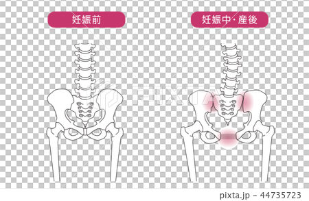 骨盤の緩み 腰部比較 骨盤の緩み 腰部比較 44735723