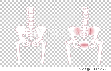 Loose pelvis 44735725