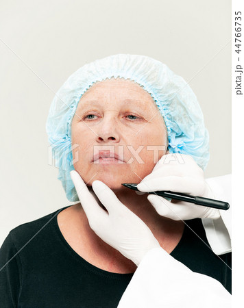surgeon doing skin check on mid age woman before plastic surgery surgeon doing skin check on mid age woman before plastic surgery 44766735