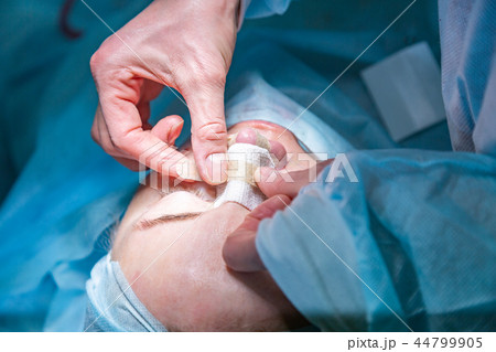 Surgeon and his assistant performing cosmetic surgery on nose in hospital operating room. Nose 44799905
