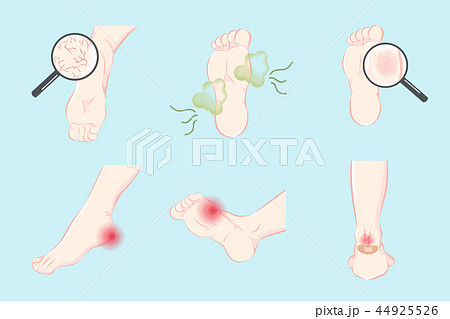 foot skin care problem set 44925526