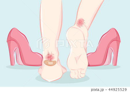 female feet in pain 44925529