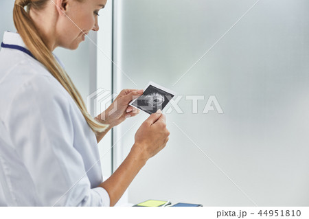 Young doctor looking at ultrasound picture of future baby 44951810