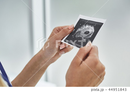 Female hands holding ultrasound picture of baby 44951843