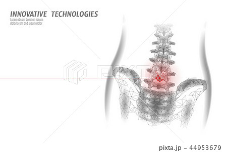 Human spine hip lumbar radiculitis pain low poly. Geometric polygonal particle triangle point line 44953679