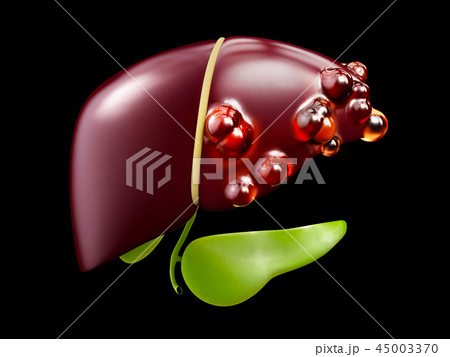 3d illustration of Diseased liver isolated black 45003370