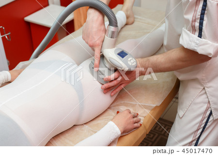 Woman having anti cellulite lpg massage Woman having anti cellulite lpg massage 45017470