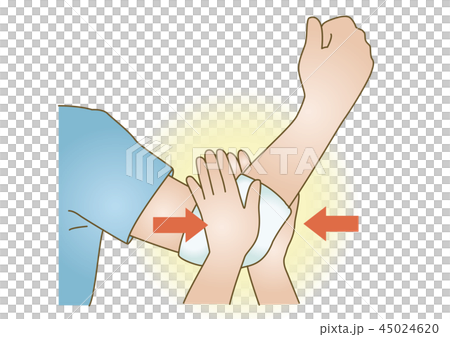 First aid treatment illustration 24: hemostasis, direct compression hemostasis method 45024620
