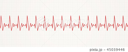 irregular fast heart beat 45039446