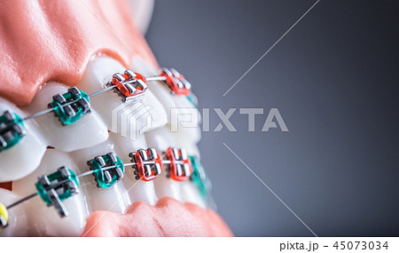 Orthodontic model jaws and teeth with braces. Orthodontic model jaws and teeth with braces. 45073034