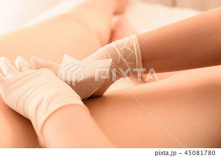 脱毛　ワックス脱毛　デリケートゾーン　施術　自然光　イメージ 45081780