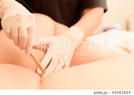 脱毛　ワックス脱毛　デリケートゾーン　施術　自然光　イメージ 45081834