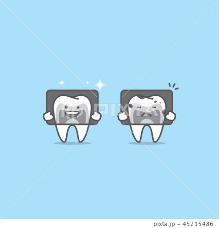 X Ray With Tooth Characters Compare Good Badのイラスト素材 45215486 Pixta