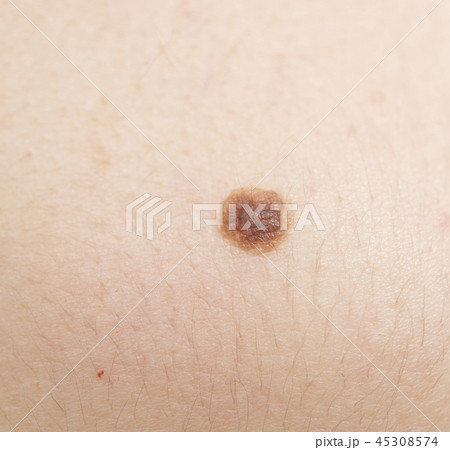 mole 45308574