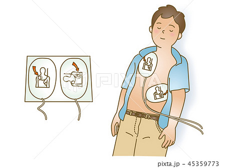 応急手当イラスト92:AED 応急手当イラスト92:AED 45359773