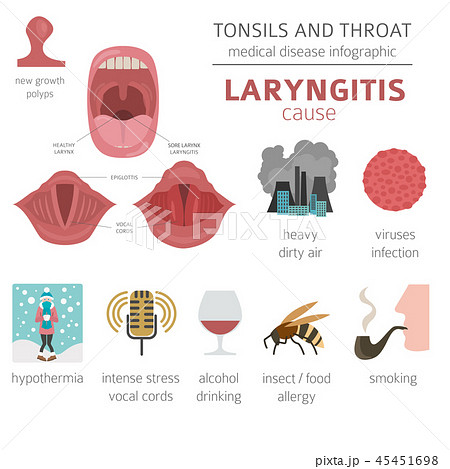 Tonsils and throat diseases. Laryngitis Tonsils and throat diseases. Laryngitis 45451698