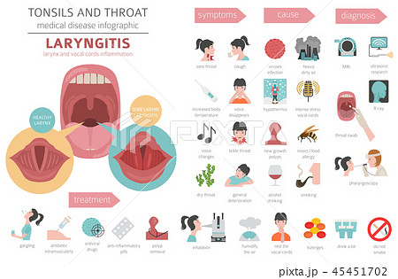 Tonsils and throat diseases. Laryngitis Tonsils and throat diseases. Laryngitis 45451702