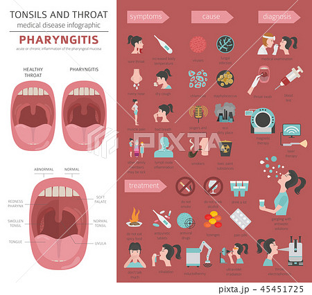 Tonsils and throat diseases. Pharyngitis  45451725