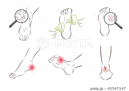 foot skin care problem set 45547147