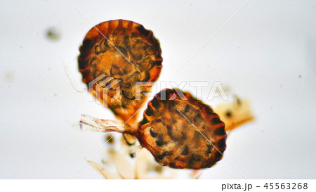 シダの胞子の顕微鏡写真 45563268