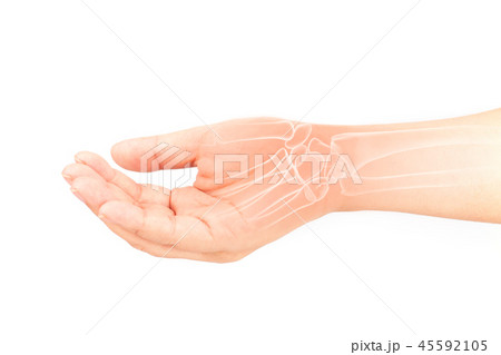 wrist bones injury wrist bones injury 45592105
