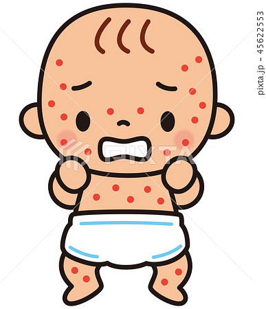湿疹の出た赤ちゃんのイラスト素材