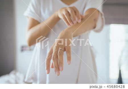 Woman with rash or papule and scratchon her arm Woman with rash or papule and scratchon her arm 45680428
