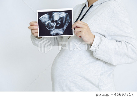 超音波エコーによる胎児の写真を見せる大きなお腹の妊婦。妊娠、胎児、健康、愛情、幸せイメージ 45697517