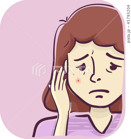 Girl Symptoms Red Spot Vein Mole Face Illustration 45793204