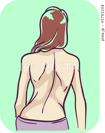 Girl Symptom Back Bone Deform Illustration 45793208