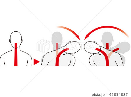 横からの衝撃などによる首の動き むち打ち症 のイラスト素材 横からの衝撃などによる首の動き むち打ち症 のイラスト素材