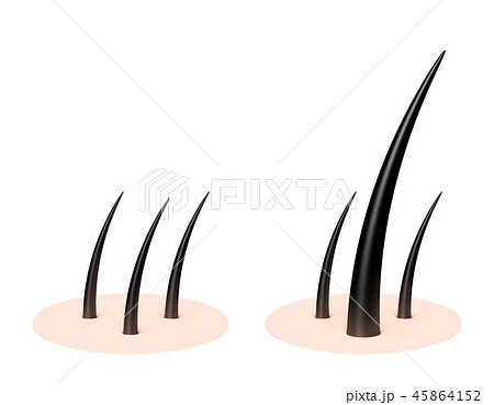 毛 髪の毛 パターン 毛 髪の毛 パターン 45864152