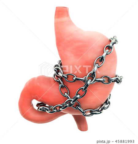 Stomach Pain concept. Human stomach with chain 45881993