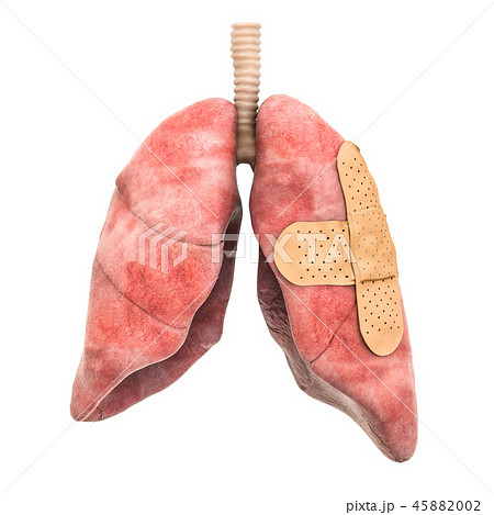 Human lungs with adhesive bandages Human lungs with adhesive bandages 45882002